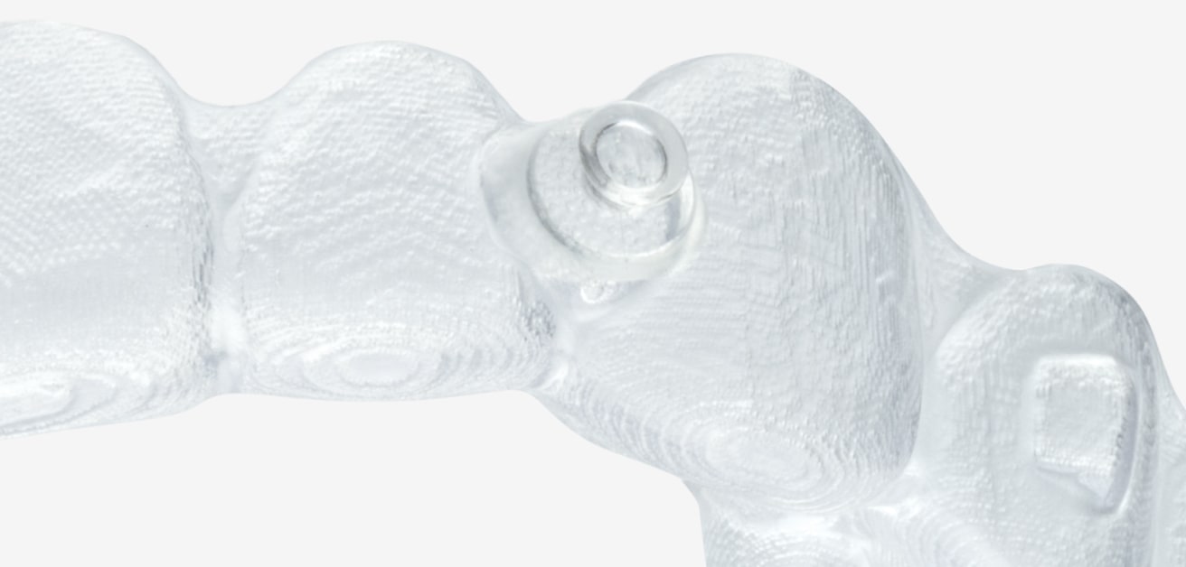 A close-up view of a transparent dental aligner with a small circular attachment, shown on a plain white background.