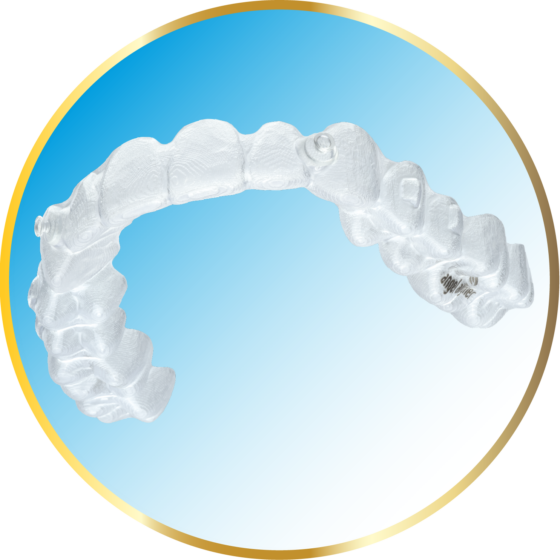 A clear dental aligner with embedded attachments displayed on a blue and white gradient background within a gold-bordered circle.