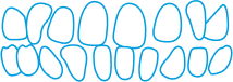 A simplified illustration of upper and lower human teeth, outlined in blue, showing the arrangement and shapes of individual teeth.