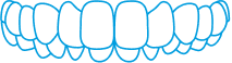 Illustration of a row of upper and lower human teeth outlined in blue, showing a symmetrical, full set with no gaps or irregularities.